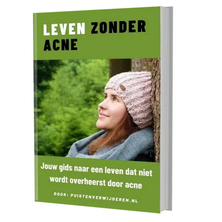 E-book Leven Zonder Acne