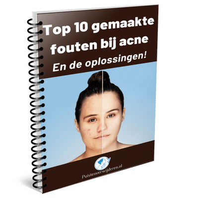 Gratis e-book over acne en puistjes